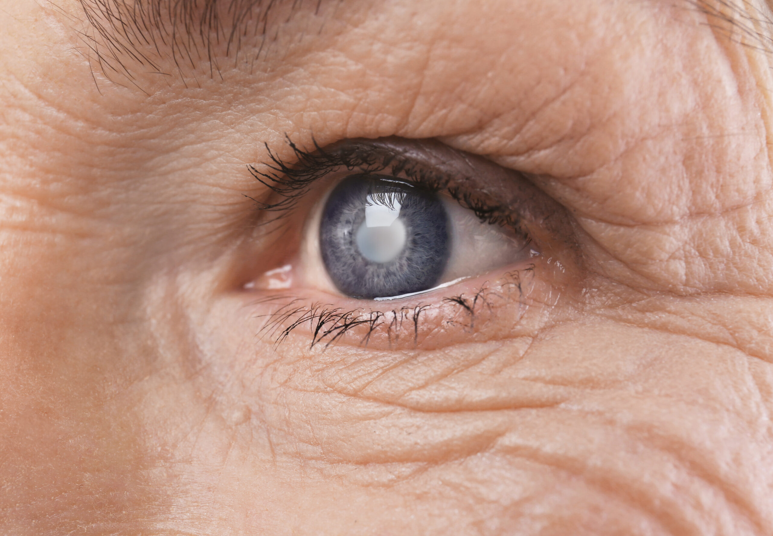 It’s National Glaucoma Awareness Month