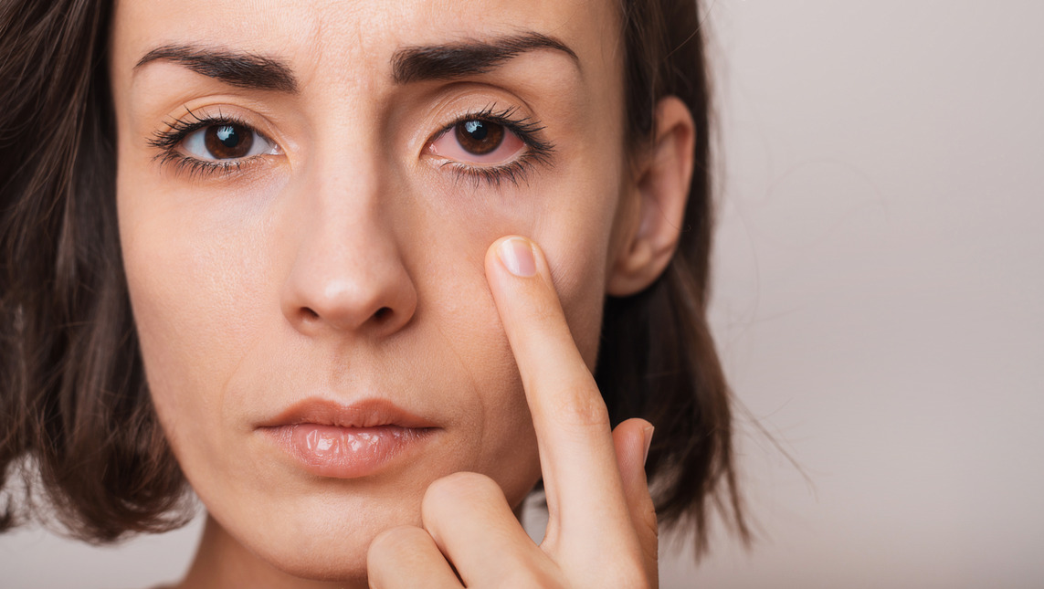Why won’t my eye doctor send me an antibiotic for my red eye without seeing me?