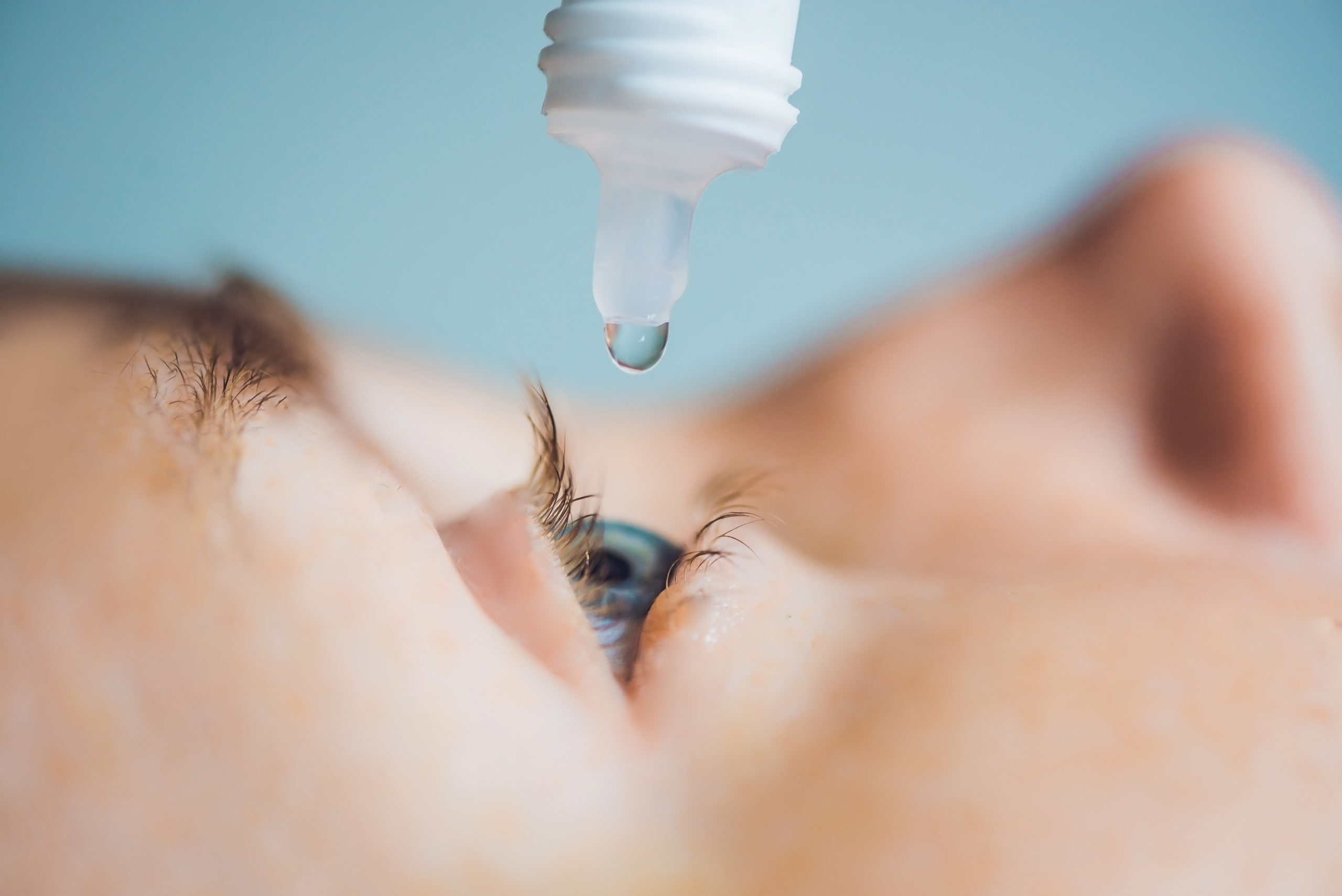 Pink Eye, Allergies and Dry Eyes: What's the Difference?