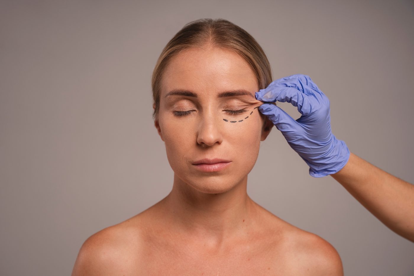 Ptosis repair droopy eyelid surgery