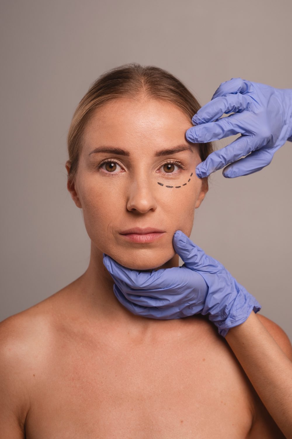 Oculoplastic evaluation at Ideal Eye Surgery